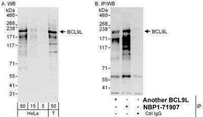 Western Blot: BCL9-2 Antibody [NBP1-71907]