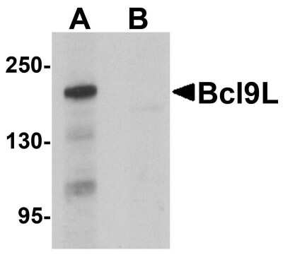 Western Blot: BCL9-2 AntibodyBSA Free [NBP1-76542]