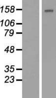 Western Blot: BCL9-2 Overexpression Lysate [NBP2-04846]