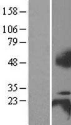 Western Blot: BCMA/TNFRSF17 Overexpression Lysate [NBL1-17151]