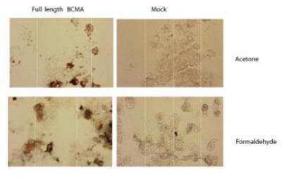 Immunohistochemistry: BCMA/TNFRSF17 Antibody (Vicky-1) - BSA Free [NBP1-97637]