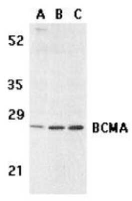 Western Blot: BCMA/TNFRSF17 AntibodyBSA Free [NBP1-76774]