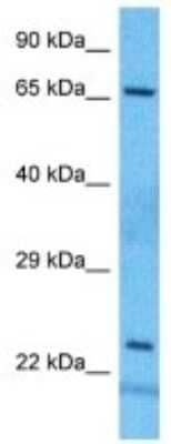 Western Blot: BCMO1 Antibody [NBP3-10784]