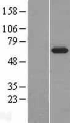 Western Blot: BCMO1 Overexpression Lysate [NBP2-06984]