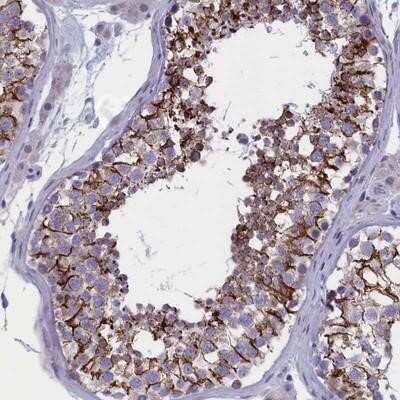 Immunohistochemistry-Paraffin: BCNP Antibody [NBP1-90771]