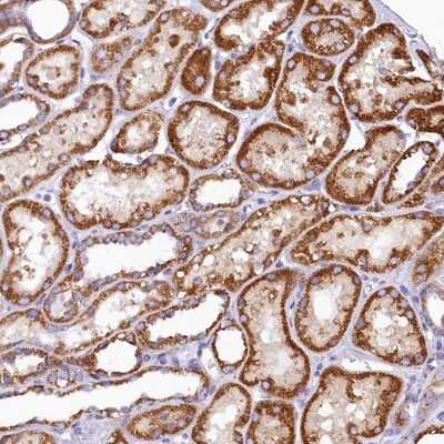 Immunohistochemistry-Paraffin: BCO2 Antibody [NBP1-90770]