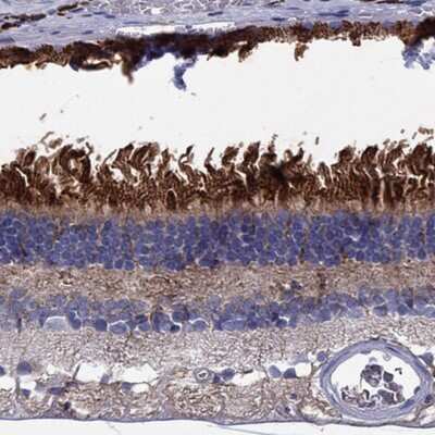 Immunohistochemistry-Paraffin: BCO2 Antibody [NBP3-17217]