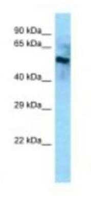 Western Blot: BCO2 Antibody [NBP1-98381]