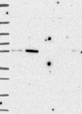 Western Blot: BCO2 Antibody [NBP3-17217]