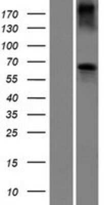 Western Blot: BCO2 Overexpression Lysate [NBP2-06095]