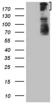 Western Blot: BCOR Antibody (OTI4F6) [NBP2-46571]