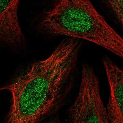 Immunocytochemistry/ Immunofluorescence: BCOR Antibody [NBP2-58057]