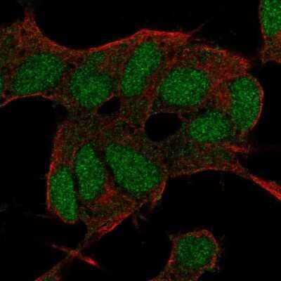 Immunocytochemistry/ Immunofluorescence: BCOR Antibody [NBP2-68956]