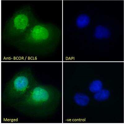 Immunofluorescence: BCOR Antibody [NB100-1280]