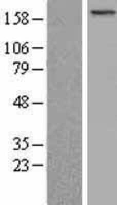 Western Blot: BCOR Overexpression Lysate [NBL1-07956]