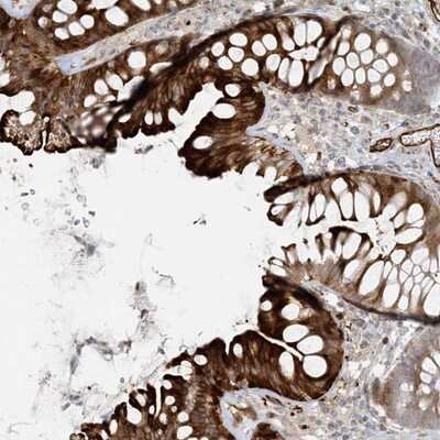 Immunohistochemistry-Paraffin: BCORL1 Antibody [NBP1-90607]