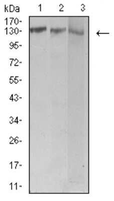 Western Blot: BCR Antibody (1E11G12)BSA Free [NBP2-61707]
