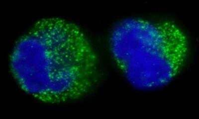 Immunocytochemistry/ Immunofluorescence: BCR Antibody [NBP1-19097]