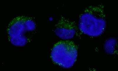 Immunocytochemistry/ Immunofluorescence: BCR Antibody [NBP1-19098]
