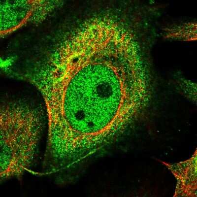 Immunocytochemistry/ Immunofluorescence: BCR Antibody [NBP1-89137]