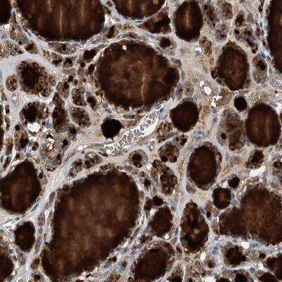 Immunohistochemistry-Paraffin: BCR Antibody [NBP1-89137]