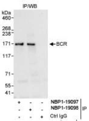 Immunoprecipitation: BCR Antibody [NBP1-19097]