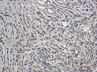 Immunohistochemistry-Paraffin: BCR Antibody (S02-6I0) [NBP3-15006]