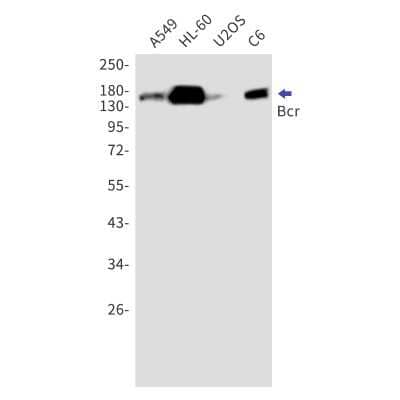 Western Blot: BCR Antibody (S02-6I0) [NBP3-15006]