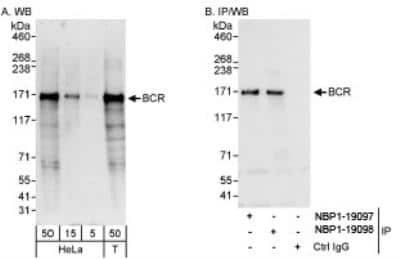 Western Blot: BCR Antibody [NBP1-19098]