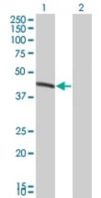 Western Blot: BCS1L Antibody (5F3) [H00000617-M01]