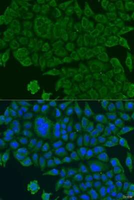 Immunocytochemistry/ Immunofluorescence: BCS1L Antibody - BSA Free [NBP2-92916]