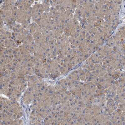 Immunohistochemistry-Paraffin: BCS1L Antibody [NBP1-88678]