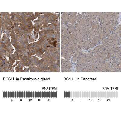Immunohistochemistry-Paraffin: BCS1L Antibody [NBP1-88678]