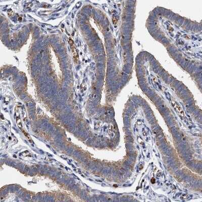 Immunohistochemistry-Paraffin: BCS1L Antibody [NBP1-88678]