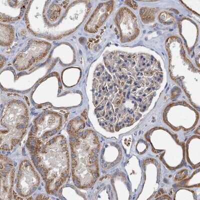 Immunohistochemistry-Paraffin: BCS1L Antibody [NBP1-88678]