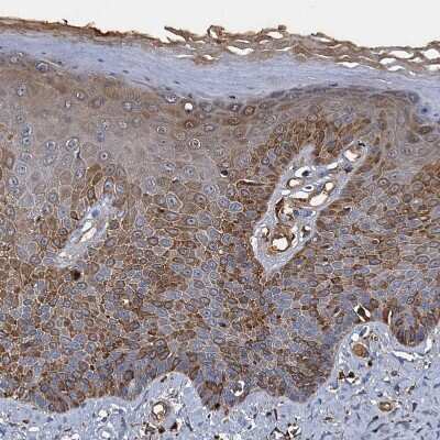 Immunohistochemistry-Paraffin: BCS1L Antibody [NBP1-88678]