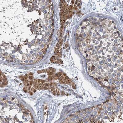 Immunohistochemistry-Paraffin: BCS1L Antibody [NBP1-88678]