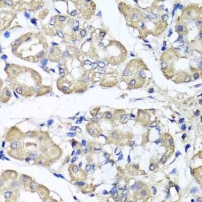Immunohistochemistry-Paraffin: BCS1L Antibody - BSA Free [NBP2-92916]