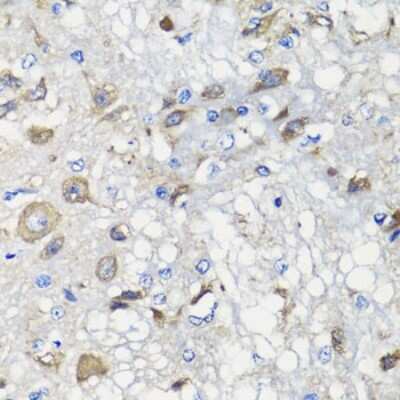 Immunohistochemistry-Paraffin: BCS1L Antibody - BSA Free [NBP2-92916]