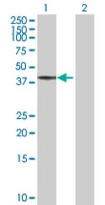 Western Blot: BCS1L Antibody [H00000617-D01P]