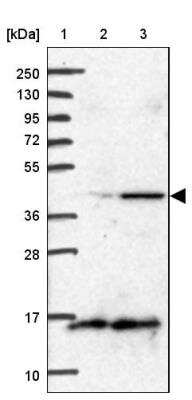 Western Blot: BCS1L Antibody [NBP1-88677]