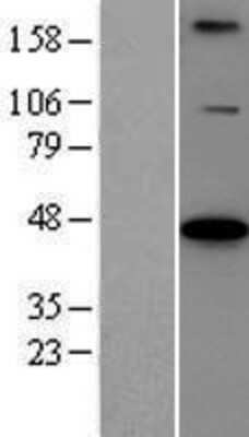 Western Blot: BCS1L Overexpression Lysate [NBP2-07879]