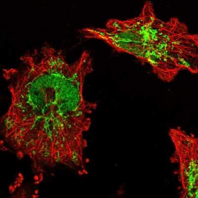 Immunocytochemistry/ Immunofluorescence: BDH1 Antibody [NBP1-88673]