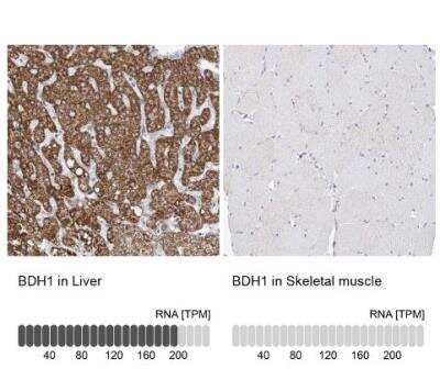 Immunohistochemistry-Paraffin: BDH1 Antibody [NBP1-88673]