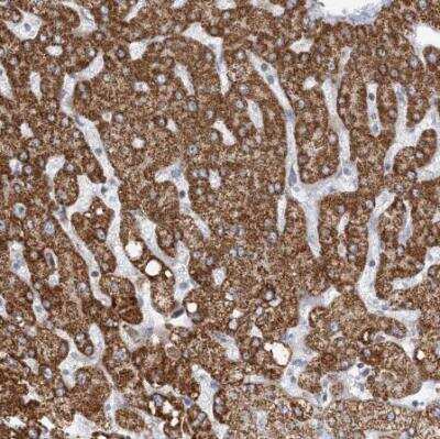 Immunohistochemistry-Paraffin: BDH1 Antibody [NBP1-88673]