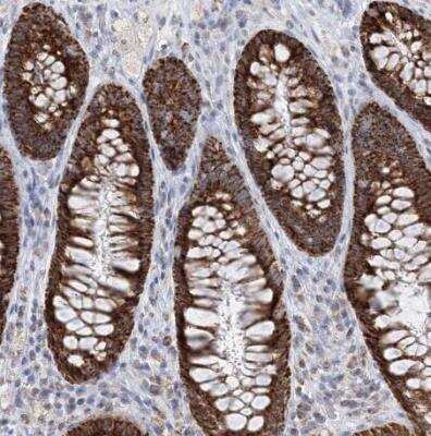 Immunohistochemistry-Paraffin: BDH1 Antibody [NBP1-88673]