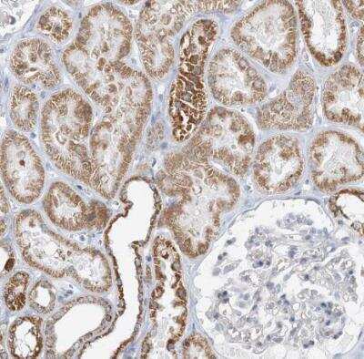 Immunohistochemistry-Paraffin: BDH1 Antibody [NBP1-88673]