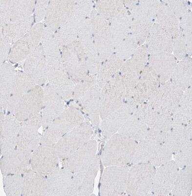 Immunohistochemistry-Paraffin: BDH1 Antibody [NBP1-88673]