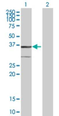 Western Blot: BDH1 Antibody [H00000622-B01P]