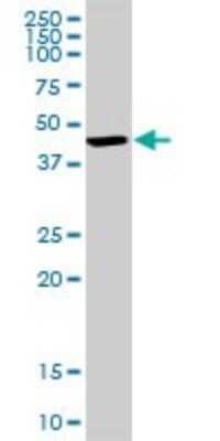 Western Blot: BDH1 Antibody [H00000622-D01P]